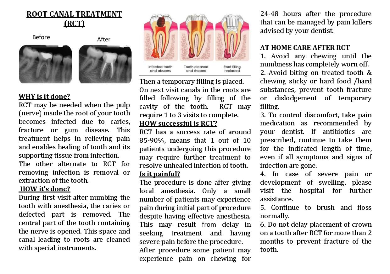 Fillings and Root Canal page 002